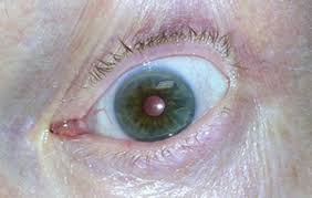 Someone who is being taught, especially.: Tonic Pupil Loosen Up