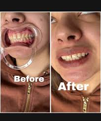 ✨ This Week's Openings at All Night Perfections ✨ We have spots available  for: ✓ Body Contouring