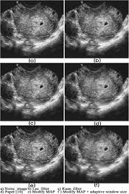 Interesting though, those who didn't read any guidelines were not any more likely to schedule a clinically unsupported thyroid ultrasound for their patient (or 1.19, 95% ci 0.67−2.10), the. Results Of Real Ultrasound Test Image 6 References Download Scientific Diagram
