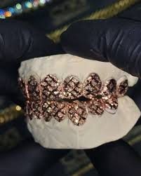 Popular by demand our custom yellow gold grillz are made with the exact purity of gold that you choose. Rose Gold Diamond Dust With Diamond Custom Gold Grillz