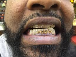 The cost will also vary from person to person, depending on your oral health and the dentist you go to. J J Gold Teeth Home Facebook