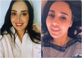 هل نرى حلا شيحة داعية إسلامية قريبا؟. Ø­Ù„Ø§ Ø´ÙŠØ­Ø© ØªÙƒØ´Ù Ø³Ø¨Ø¨ ØªØºÙŠØ± Ù…Ù„Ø§Ù…Ø­ ÙˆØ¬Ù‡Ù‡Ø§ Ù„Ù… Ø£Ø¬Ø± Ø¹Ù…Ù„ÙŠØ© ØªØ¬Ù…ÙŠÙ„ Ø®Ø¨Ø± ÙÙŠ Ø§Ù„ÙÙ†