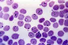 Plasmodium, commonly known as malaria parasites, may be described as a genus of intracellular parasitic protozoa. Plasmodium Falciparum Caracteristici Morfologie Ciclul De ViaÈ›Äƒ Simptome Thpanorama Acum DeveniÈ›i Mai Buni