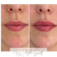 Natalie Everett Aesthetics (@natalie.everett.aesthetics) • Instagram photos  and videos