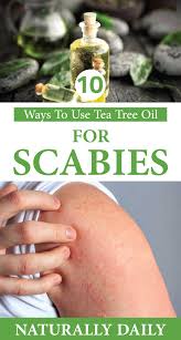 How To Use Tea Tree Oil For Scabies Treatment Scabies Treatment Tea Tree Oil Uses Tea Tree Oil For Acne
