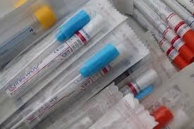 Oropharyngeal Secretions May Help Reduce False Negative Covid 19 Test Results