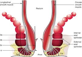 Image result for Fecal Incontinence