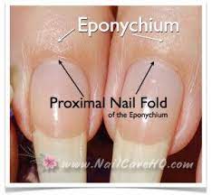 Cuticle Care Proximal Fold Of The Eponychium How To Grow Nails Nail Care Nails