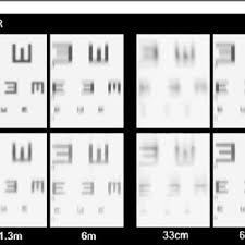 On occasion, the patient may notice floaters, flashing lights and loss of peripheral vision which may present as a shadow moving toward the center of one's field of vision. Pdf Eyelid Squinting Improves Near Vision In Against The Rule And Distance Vision In With The Rule Astigmatism In Pseudophakic Eyes An Eye Model Experimental Study