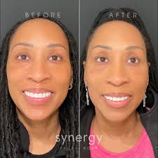 Synergy Face + Body (@feelsynergy) · Instagram 照片和视频