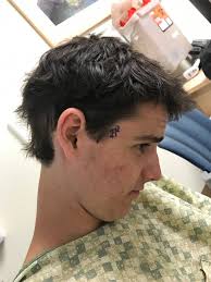 Hey Everyone, So Bryce just went back to the surgery room but we did have a  small laugh prior to him going back! The nurse comes over and takes a  sharpie and