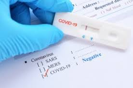 Drops of this solution are place on a paper test cartridge which contains coronavirus antibodies. Sars Cov 2 Covid 19 Diagnosis By Igg Igm Rapid Test Clinisciences