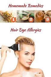 3 Effective Solutions To Treat Hair Dye Allergies Hair Dye Allergy Home Remedies For Hair Thick Hair Remedies
