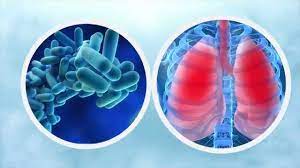 It's caused by the bacterium legionella pneumophila found in both potable and nonpotable water more hospitals are facing the dilemma of legionella outbreaks as they discover the drinking water is. Legionella Spp Youtube