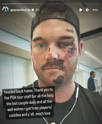 Rising golf star Grayson Murray commits suicide, raising concerns abou