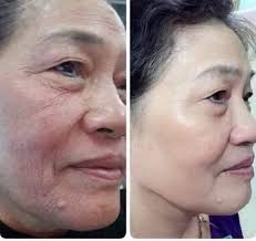 I hope everyone had a wonderful Christmas 🎄!!! Now I have to tell you that  my fave BOTOX SERUM in a PUMP is $71 off! 🤯 It normally comes out twice per