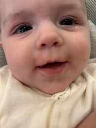 Hello Everyone, My beautiful wife made these allergy cards to help in  restaurants and raise awareness. We forgot garlic puree as a possible one  as sometimes it is mixed with Oil -