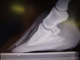 Hoof Help White Line Disease Us Equestrian