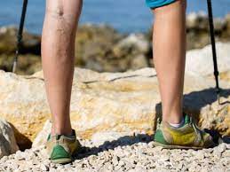 Here are 8 simple instructions on how to reduce swelling after lipo. Travel And Lower Leg Swelling Active