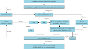 How to test for pulmonary embolism. Comparison Of International Societal Guidelines For The Diagnosis Of Suspected Pulmonary Embolism During Pregnancy The Lancet Haematology