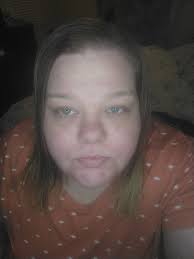 Did Laura from General Hospital have facial work done?