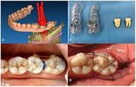 Dentistry Journal | Free Full-Text | Computer-Guided Surgery Can ...