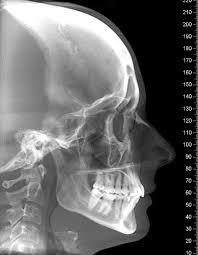 Pin By Asleigh Pusey On Art And Drawings Xray Art Anatomy X Ray