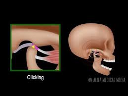 Pin On Nerve Pain