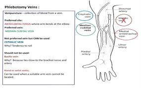 The left arm of a human male. Venipuncture And Arterial Puncture Policy