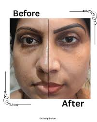 You don't have to be happy to smile.” —Daniel Willey #dermatologist  #DermatologyCare #glowingskin #pujospecial