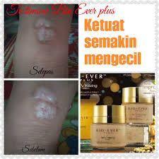 Krim bio ever plus di perbuat dari bahan semulajadi. Mini Stokis Agent Sah Hai O Alor Setar Kedah 2018 Bio Ever Plus