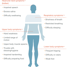 What Is Als Als Symptoms Als Pathways