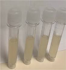 Image result for CSF Culture