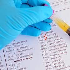 Image result for Herpes Simplex Virus Testing