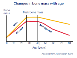 Imu News Osteoporosis Are You At Risk Of Broken Bones