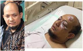 Ada 20 gudang lagu garagara novel baswedan mata najwa setop tayang terbaru, klik salah satu untuk download lagu mudah dan cepat. Novel Baswedan Selesai Jalani Operasi Tambahan Di Mata Kiri