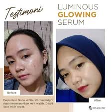 Supply ability:50,000 sq.m / month. Hang Má»›i Vá» Serum Phat Sang Ä'á»™c Ä'ao Tiá»‡n Dá»¥ng Gia Cáº¡nh Tranh