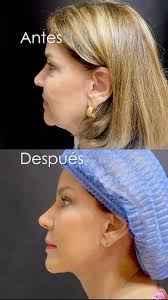 Dr Dario Felipe Cabello