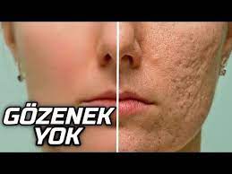 2418 ilk yaptiginizda hayretler icinde kalacaksiniz gozenek kapatici maske cilt bakimi youtube cilt bakimi dogal akne tedavisi cilt beyazlatma