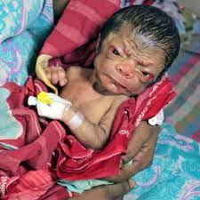 Baby Born Looking Like An 80 Year Old Man Mimicking Brad Pitt Film The Curious Case Of Benjamin Button World News Mirror Online