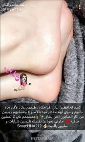 pin by waad on وصفات منوعه beauty skin care routine facial skin care routine skin care diy masks