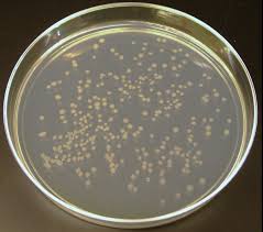 Escherichia coli (abbreviated as e. Escherichia Coli