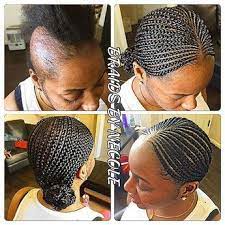 By Braidsbynecole1 No Glue Used And No Tension Did The Feed In Braid Technique And Created Braids On Top Of A Alopecia Hairstyles Feed In Braid Hair Styles