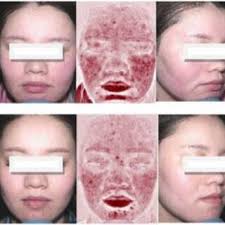 Xing Fan's research works