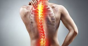 Lo schiacciamento vertebrale lombare è una situazione in cui due o più vertebre si trovano troppo tipicamente si riscontrano schiacciamenti a partire dalla terza vertebra lombare in giù, quindi nei. Tout Savoir Sur La Fracture Des Vertebres A Paris Institut De Kinesitherapie