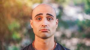 Women too are more likely to lose hair if they have a family history of hair loss. Hair Loss Why It S Happening To Millennials
