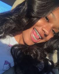 Black And Blue Braces Together 
