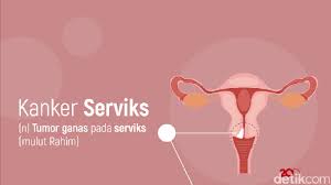Check spelling or type a new query. Periksa Kanker Serviks Gratis Di Rson Cibubur