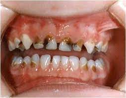 We did not find results for: The Dentist Your Perfect Smile