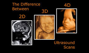 Untuk pengetahuan anda, klinik kesihatan merupakan klinik yang disediakan oleh kerajaan untuk membantu rakyat malaysia mendapatkan perkhidmatan klinik kesihatan au2. Baby Scan An Ultrasound Scan Klinik Mediviron Sri Gombak Facebook